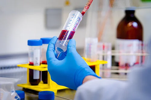 blood sample in the lab